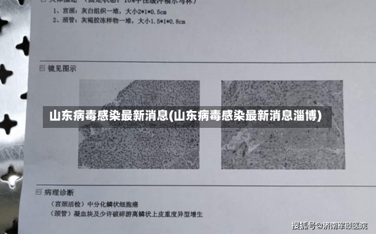 山东病毒感染最新消息(山东病毒感染最新消息淄博)